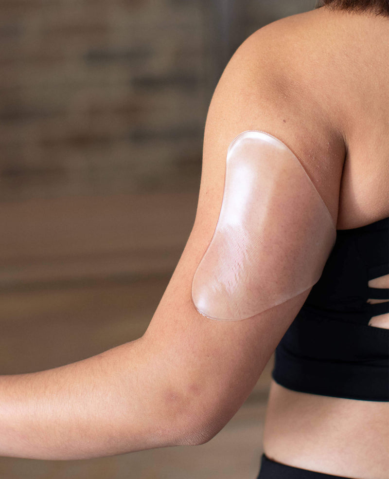 Arm-Stretch-Mark-Reduction