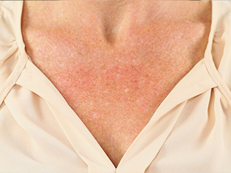 Booby-Wrinkle-Removal-Product-After Booby-Wrinkle-Removal-Product-After
