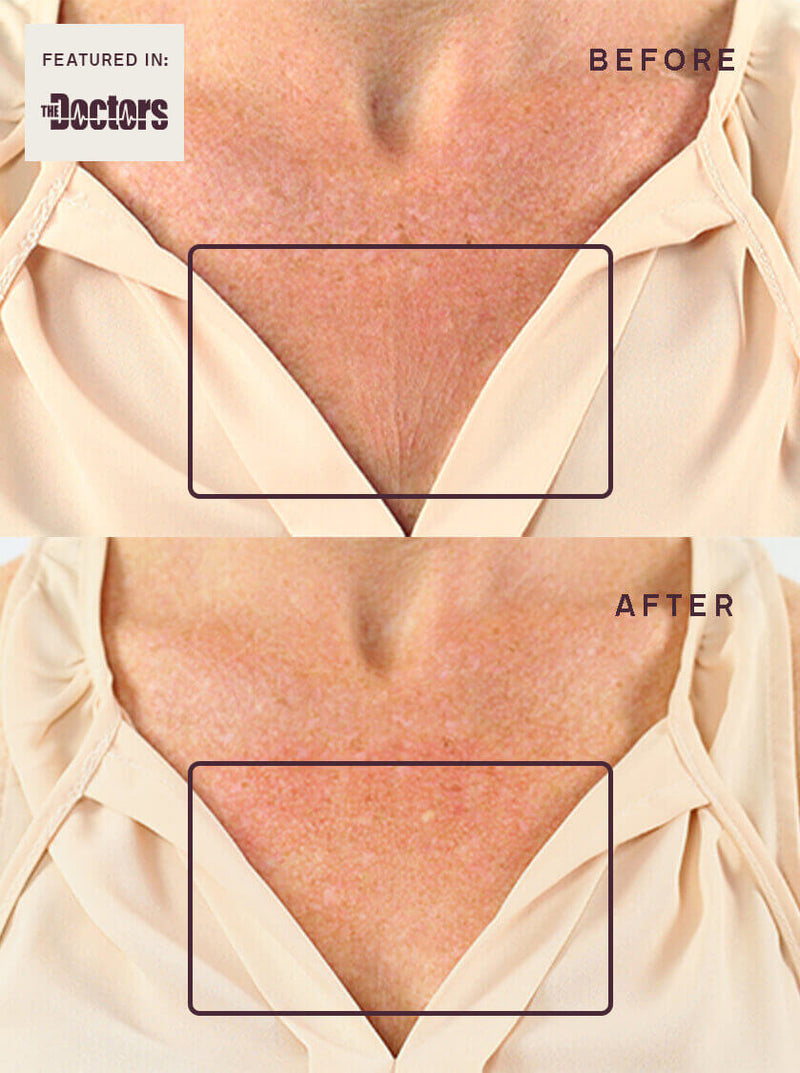 OUR BOOBY STRETCH MARK KIT OUR BOOBY STRETCH MARK KIT