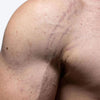 Post-Workout Stretch Mark Kit