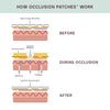Eyes & Mouth Occlusion Patches™
