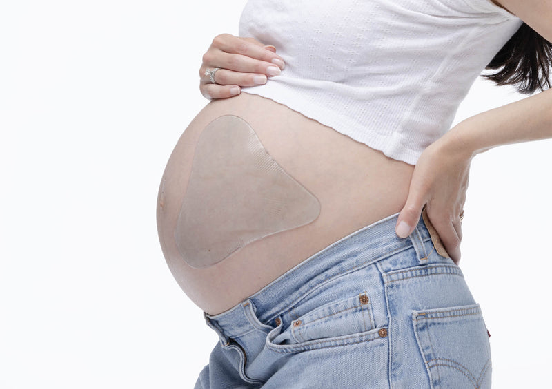 Stretch-Mark-Removal-Product-Pregnancy Silicone Fusion