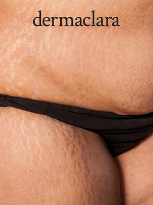 Does Dermaclara Clarafuse Work On All Skin Types And Skin Tones?