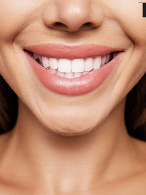 How to Treat and Prevent Marionette Lines