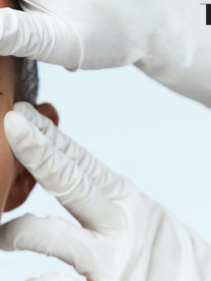 The Best Ways to Get Rid of Eye Lines