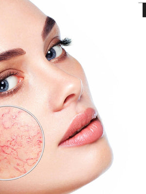 Banish Dry Facial Skin with These Tips and Treatments