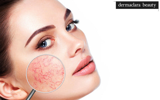 Banish Dry Facial Skin with These Tips and Treatments