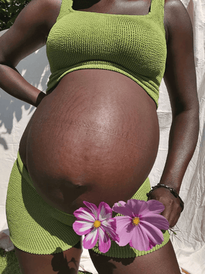 Are stretch marks dangerous?