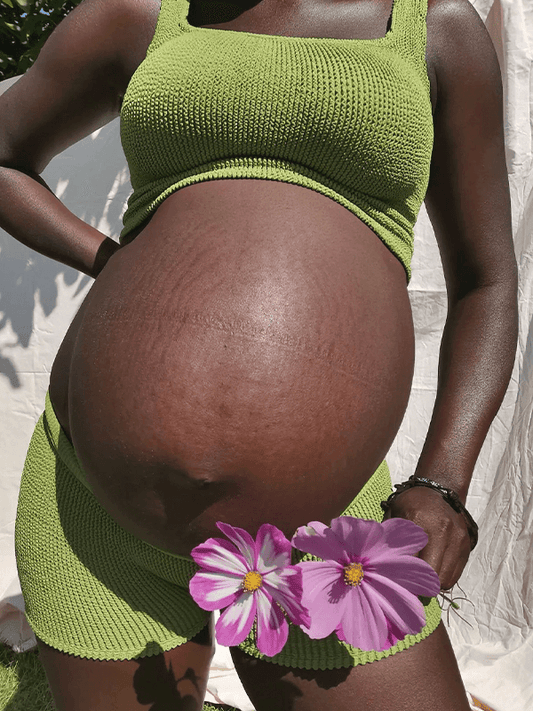 Are stretch marks dangerous?