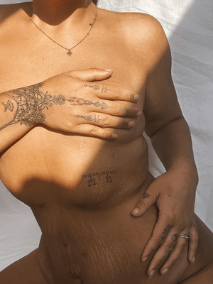 What causes cellulite?