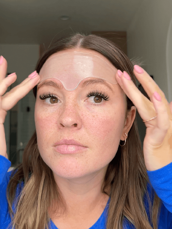 acne prone skin