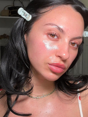 Transform Your Skin: The Benefits of BBL Laser Treatment Explained