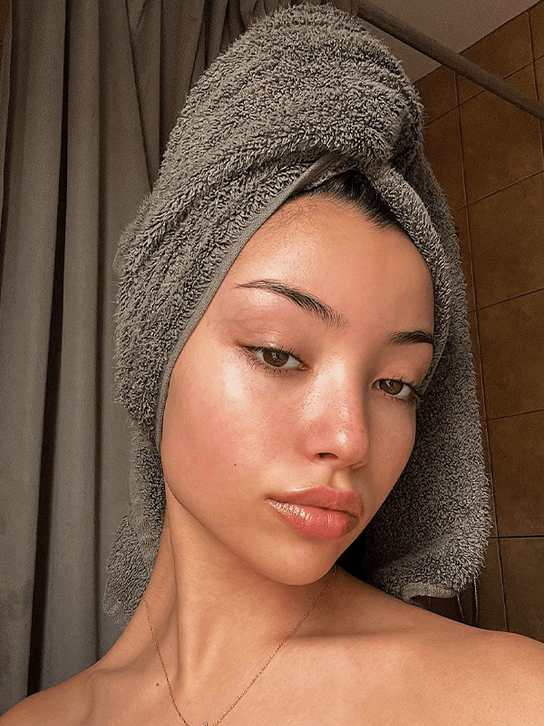 best moisturizer for dry skin