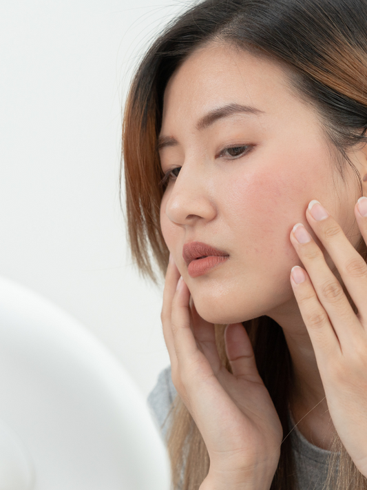 hyperpigmentation