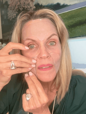 What Are Nasolabial Folds?