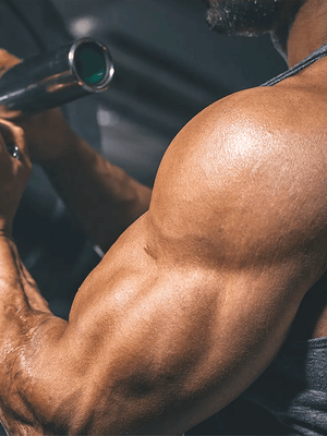 Does Bodybuilding Cause Stretch Marks?