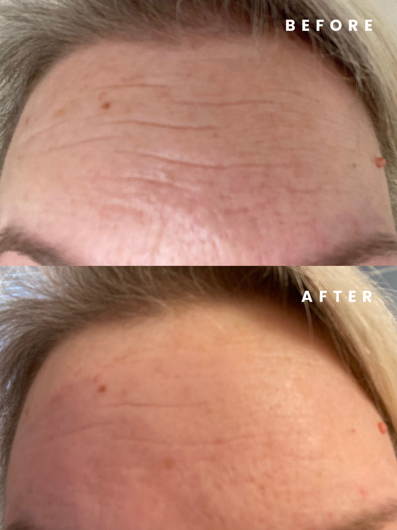 CLINICALLY PROVEN RESULTS