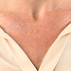 Booby_Wrinkle_Before
