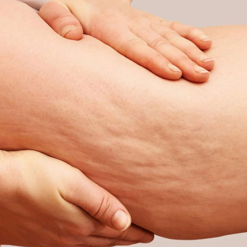 Booty Boosting Cellulite Kit