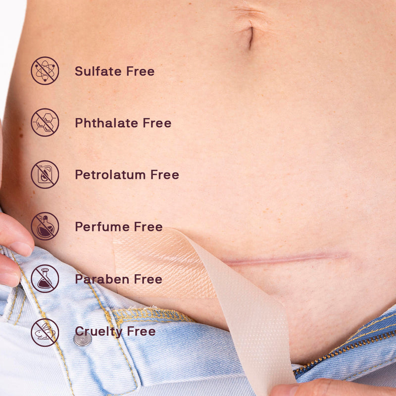 Prime Scar Occlusion Patch™ Kit