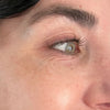 Eye_Wrinkle_Before