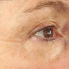 Eye_Wrinkle_Before_Old