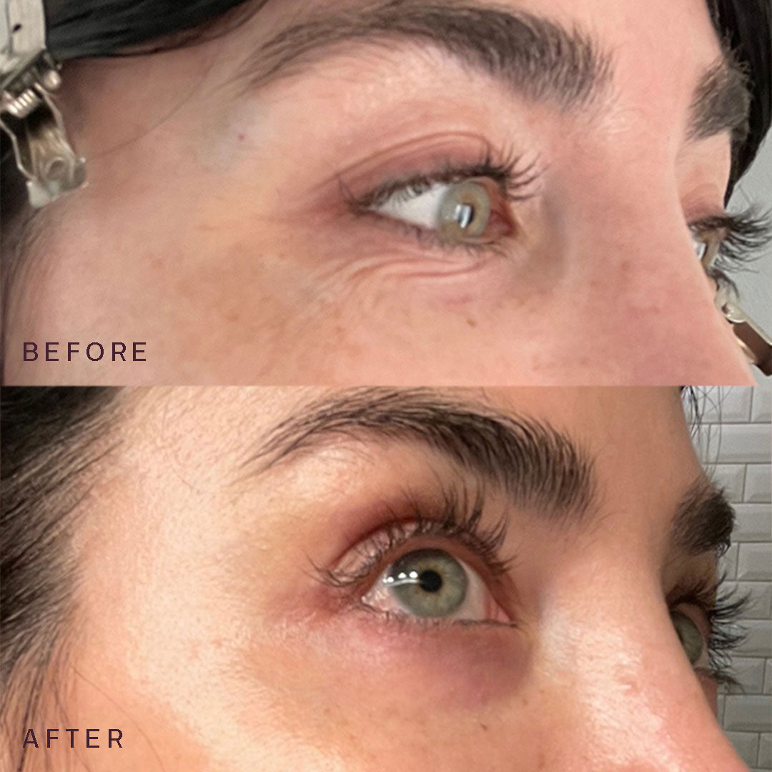 The Face Occlusion Patch®