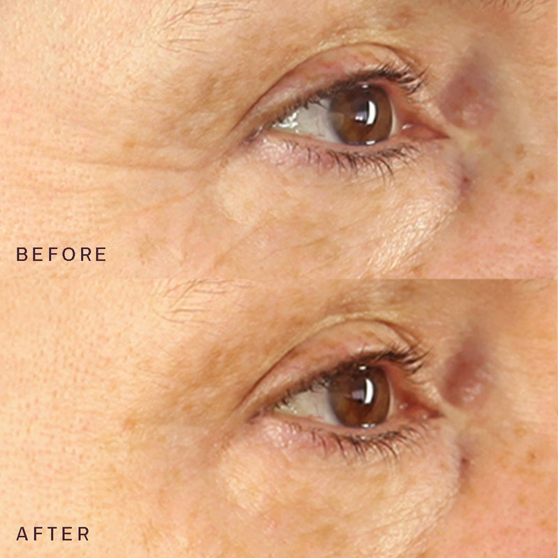 Eyes & Mouth Occlusion Patches™