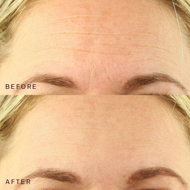 Eyes, Mouth, & Forehead Occlusion Patches™