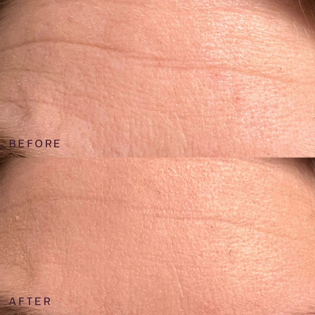 The Face Occlusion Patch®