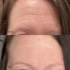 Prime Face Occlusion Patches™