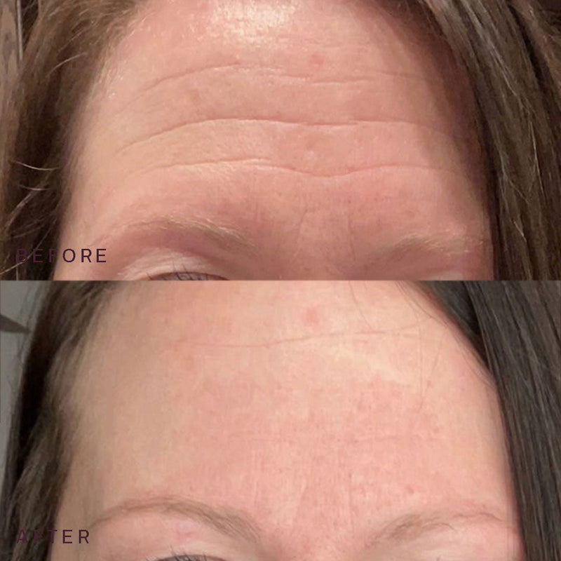Eyes, Mouth, & Forehead Occlusion Patches™