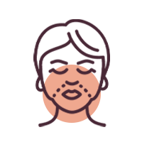 Jowls & Marionette Lines