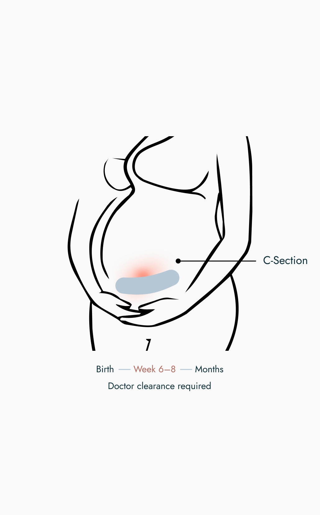 C-section