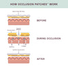 Prime Face Occlusion Patches™