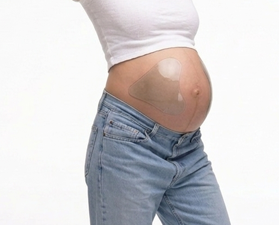 Dermaclara silicone stretch mark occlusion patch