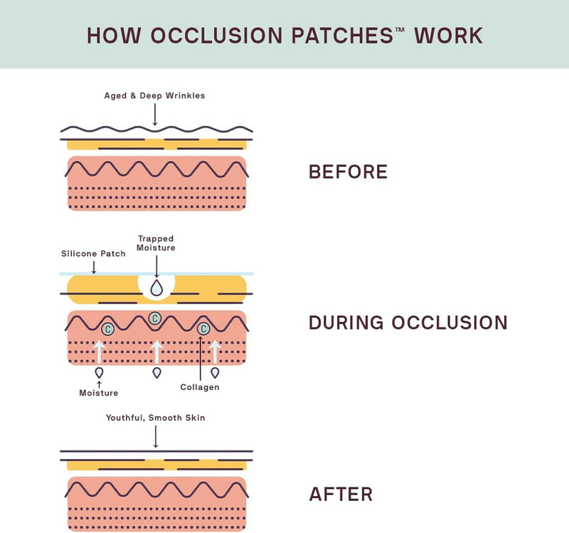 Chest & Body Occlusion Patch™