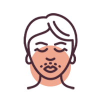 Vertical Mouth Lines