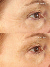 Forehead Occlusion Patch™